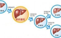 干细胞与干预治疗肝纤维化有什么作用？如何预防肝纤维化的发生？