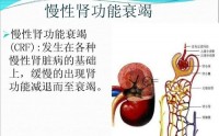 慢性肾功能衰竭是怎么引起的？干细胞与治疗肾功能衰竭的作用原理！