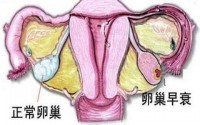 卵巢功衰退能怎么办？干细胞真能治疗修复卵巢早衰吗？