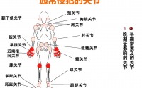 风湿病关节炎怎么治好？小分子肽对骨关节病有什么作用？