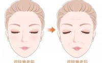 如何延缓皮肤衰老？干细胞疗法与改善皮肤老化的作用！