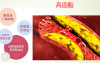 纳豆地龙蛋白肽对高血脂的功能,血脂高吃纳豆地龙蛋白肽可以吗?