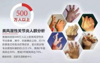 类风湿关节炎怎么治疗效果好？干细胞疗法真能治疗类风湿关节炎吗？