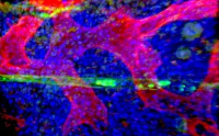 Cancer Cell：胶原蛋白不简单！首次发现胶原蛋白有助于阻止癌细胞发展