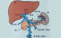 骨髓纤维化发病之二——热毒蕴肝、瘀血阻滞