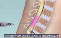 干细胞在修复脊髓方面的作用
