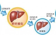 干细胞可以治疗肝硬化吗？干细胞治疗肝硬化的作用原理！