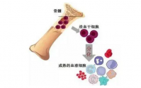 骨髓——生命健康的银行
