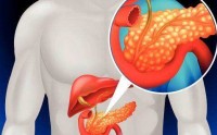 胰腺炎是什么原因引起的？如何预防胰腺炎的发生？