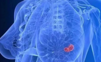 小分子肽能不能改善乳腺增生？肽对乳腺增生管用吗