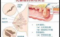 女性乳腺癌是什么原因造成的？干细胞疗法对乳腺癌的作用原理！