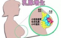 乳腺增生及腋窝淋巴结肿大怎治效果好？纯中药外敷疗法能治好乳腺增生吗？