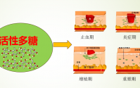 活性多糖与伤口愈合的应用有哪些,活性多糖对伤口愈合的影响。
