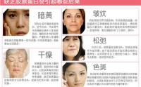 滋养肌肤需要补充鱼胶原蛋白肽，鱼胶原蛋白肽与抗衰老的作用！