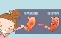 胃炎怎么办？几丁聚糖真能健胃养胃吗？几丁聚糖甲壳素的功能作用！
