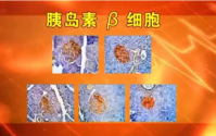 科学家发现苦瓜肽除了降血糖,竟然还可以抑制艾滋病毒!