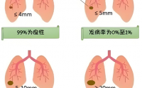 肺结节如何预防和保养,肺结节吃什么中药调理？