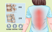 颈椎与腰椎病变竟然直接关乎气血！