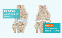 胶原蛋白肽对骨骼效果好吗？真的可以修复软骨吗