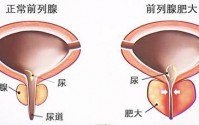 牡蛎肽可以改善前列腺功能吗？如何防治前列腺炎前列腺增生？