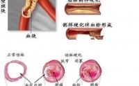 血管老化的危害不容忽视！小分子肽预防血管疾病有什么作用？