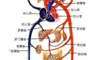 骨髓纤维化发病原因之五——瘀血内停