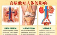 痛风真的很痛？痛风该怎么治疗才能缓解疼痛？干细胞真的可以治疗痛风吗？