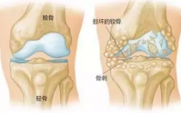 小分子肽真的能治疗好关节炎吗?