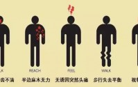 脑中风怎么能恢复？干细胞疗法与治疗脑中风的作用机制！