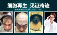 小分子肽：肽对神经系统的保护及肽在人体内的作用