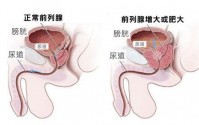 前列腺炎的危害不可忽视！干细胞治疗前列腺炎有效果吗？