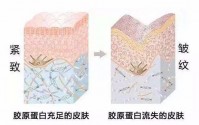 为什胶原蛋白肽一直是女人喜欢的补充剂？口服胶原蛋白有什么好处？