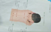 脏腑点穴推拿导引法培训