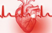 心梗有哪些前兆与诱发原因