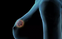 乳腺增生服用小分子活性肽有什么好处吗？