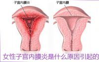 子宫内膜炎影响生育吗？干细胞疗法与子宫内膜损伤修复作用！