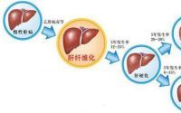 干细胞与干预治疗肝纤维化有什么作用？如何预防肝纤维化的发生？