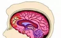 脑卒中怎么治疗好？干细胞与治疗脑卒中的临床应用研究！