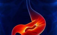 肠胃不好会有哪些症状表现？小分子肽对修复肠胃功能有哪些作用？