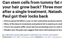 脱发最新治疗方法效果奇好——干细胞疗法