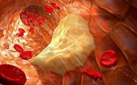 心脑血管疾病为什么一定要服用小分子肽？——肽是如何修复血管的