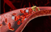 日本纳豆激酶溶解血栓效果怎么样,纳豆激素溶解血栓的原理