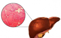 枸杞子多糖促进肝脏细胞的再生