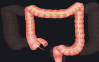 大肠的消化作用与膳食纤维促进排便