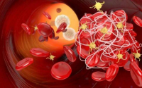 纳豆激酶与预防血栓溶解血栓及高血压的干预