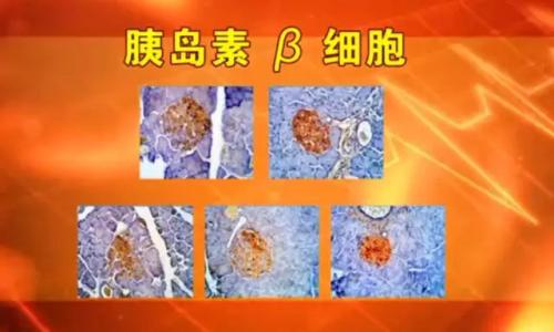 修复胰岛β细胞.jpg