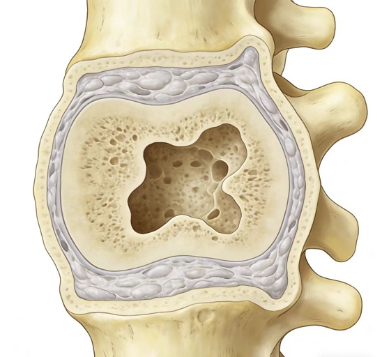 骨髓空洞.jpg 骨髓空洞.jpg